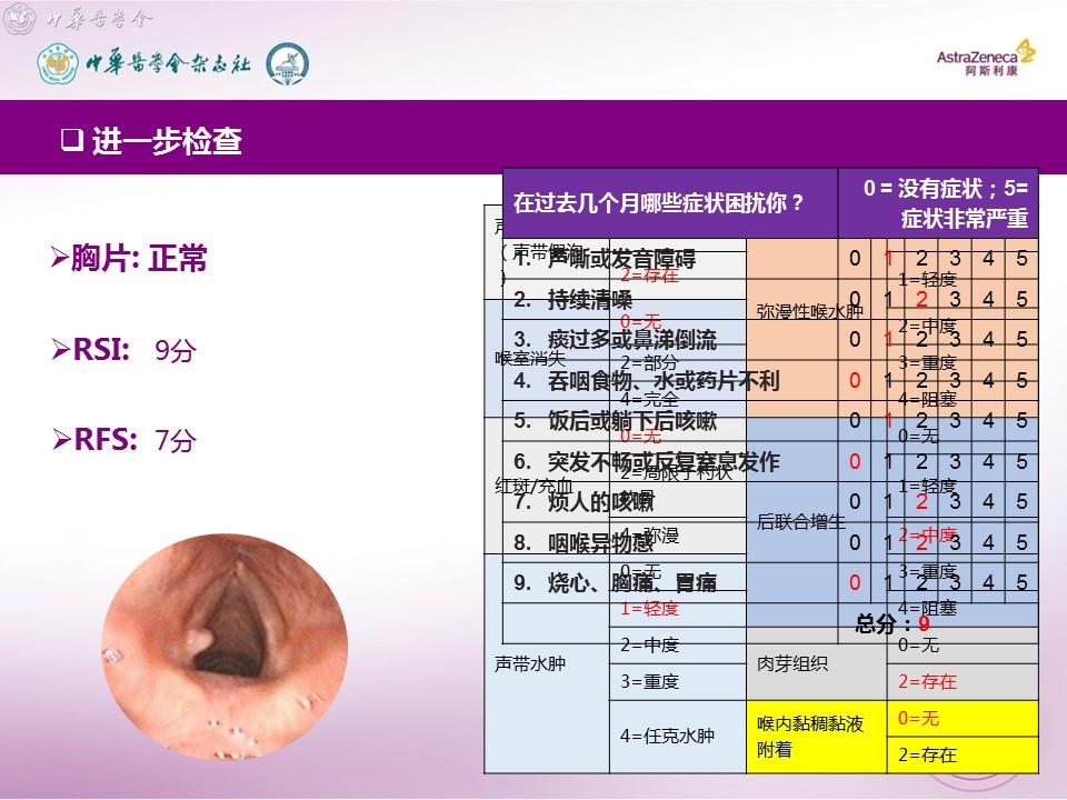 二等奖 1例咽喉反流所致喉接触性肉芽肿的诊治体会