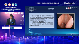 嗜酸粒细胞性鼻窦炎鼻内镜下全组鼻窦开放术