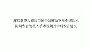 环后黏膜入路线型闭合器辅助下喉全切除术同期发音管植入1例